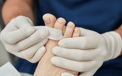 Metoda Arkady – innowacyjna metoda w leczeniu wrastających paznokci!