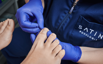 Klinika Satin – o leczeniu wrastających paznokci i wkręcających się paznokci opowiada podolog Hanna Suchecka