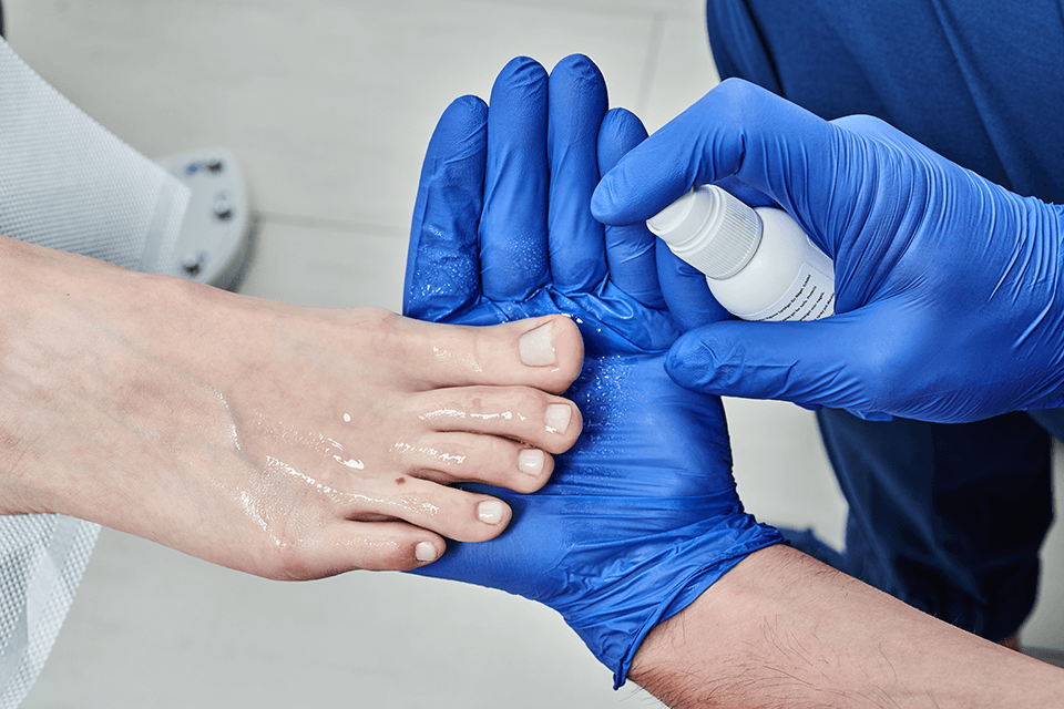 Grzybica paznokci u stóp to choroba, z którą należy zgłosić się do specjalisty, czyli lekarza podologa