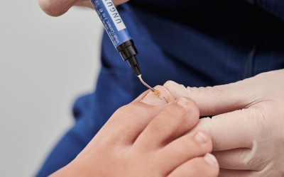 Klinika Satin – o zabiegu rekonstrukcji paznokci